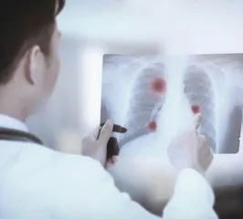 青少年肺结节的中医疗法