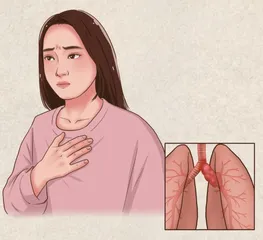 青少年肺结节的中医疗法1