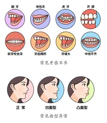 青少年牙列不齐需要矫正吗?1
