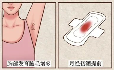 儿童性早熟防治攻略