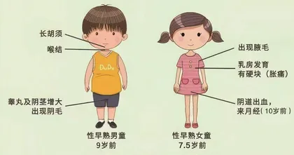 儿童性早熟防治攻略2