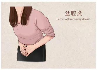 盆腔炎可致不孕