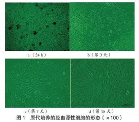 经血源性子宫内膜间充质干细胞的分离、体外扩增及形态学特点