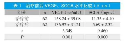 信迪利单抗联合安罗替尼治疗PD-L1阳性晚期宫颈癌的临床疗效和安全性研究
