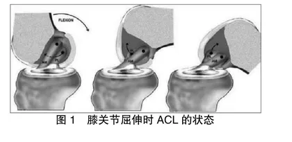 篮球运动员前交叉韧带重建术后的康复过程研究