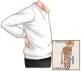 做血液透析后，需要注意这几点