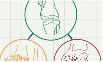 MRI弥散加权成像如何筛查骨肌肿瘤