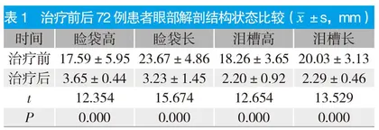 经结膜入路眼袋并睑眶沟畸形矫正术的临床效果观察
