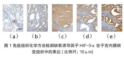 HIF-3α蛋白检测在子宫内膜病变筛查中的应用价值1