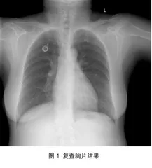 1例结肠肝曲癌术后突发输液港功能障碍的原因分析及护理