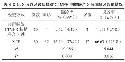 多层螺旋CT多平面重建联合X射线摄影在股骨颈骨折中的诊断价值4