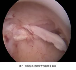 中西医结合治疗宫腔粘连合并胎骨残留后妊娠1例