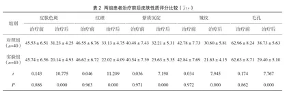 分析光子嫩肤仪用于面部黄褐斑患者治疗的临床效果2