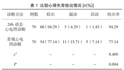 24h动态心电图在心律失常患者诊断中的实施意义1