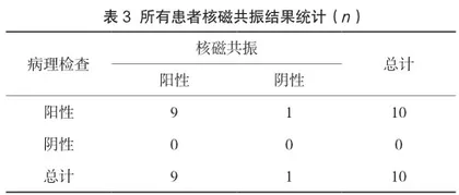 分析核磁共振对椎管肿瘤的诊断及临床价值3