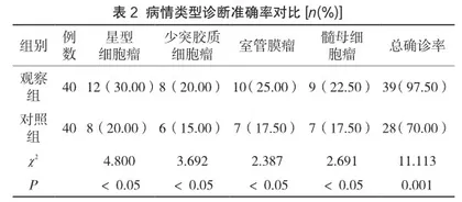 多层螺旋CT在诊断脑胶质瘤中临床应用效果分析2