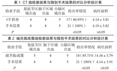 磁共振成像与CT诊断脑梗死并脑出血的应用价值评价