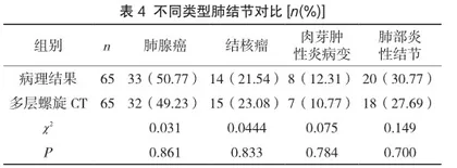 多层螺旋CT对DR诊断无症状孤立性肺结节的作用4