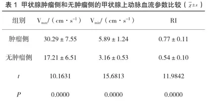甲状腺癌应用CT联合高频超声诊断的价值浅析