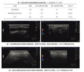 超声诊断急慢性阑尾炎的准确性及临床价值