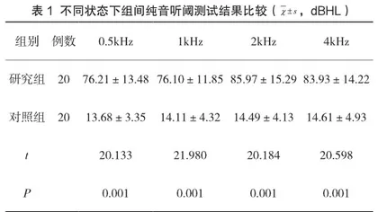 声导抗与纯音听阈测试在伪聋鉴别诊断中的作用