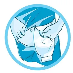 “造口人”的护理，这些事项要注意