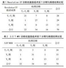 Revolution CT与3.0T MRI术前诊断结直肠癌分期的对比分析