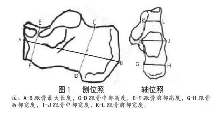 跟骨粉碎性骨折畸形愈合量化判定方法初探