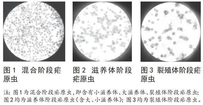 约氏疟原虫红内期不同发育阶段虫体蛋白电泳分析