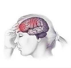 偏头痛就是一边脑壳痛？才不是！