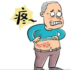 皮疹虽退仍痛，警惕带状疱疹后遗神经痛