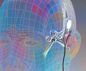 前沿新技,架起 “听声之桥”2