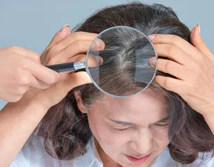 头发白了千万别乱拔1