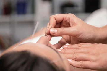 针灸要适度，3个穴位改善面瘫尴尬1