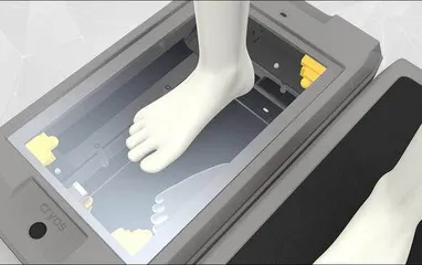脚底板痛、小腿外翻、扁平足?3D定制鞋垫了解一下2