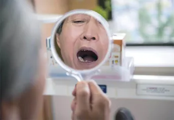 口腔溃疡经久不愈,别忽视口腔癌1