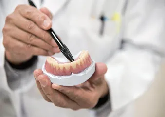 口腔溃疡经久不愈,别忽视口腔癌4