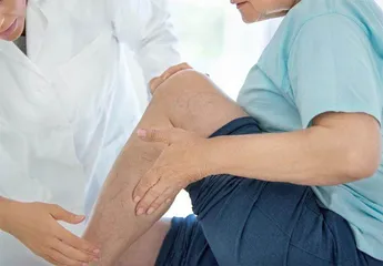 别让你的腿变成“葡萄藤”1