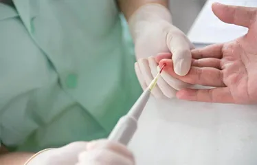 容易被体检忽略的血液坏家伙