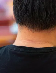 “扫黑除恶”灭“危肌”1