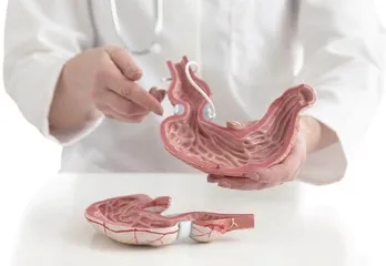 让胃“躺平”的胃轻瘫综合征1