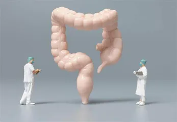 结直肠癌围手术期,中医妙用不可忽视1