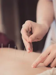 结直肠癌围手术期,中医妙用不可忽视2