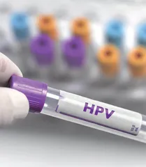 绝经后持续感染HPV,当心一“拖”成癌2