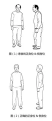 伸筋行气导引法，助力帕金森康复