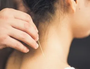 懂得这些知识，针灸效果会更好