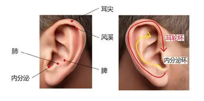 银屑病反复，试试双环按摩