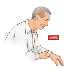 手臂发麻,成因复杂1