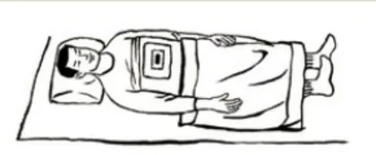 灸引升阳,冬病夏防1