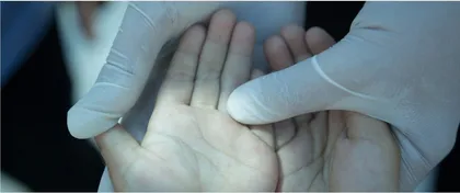 儿童注意3方面,远离手足口病!1